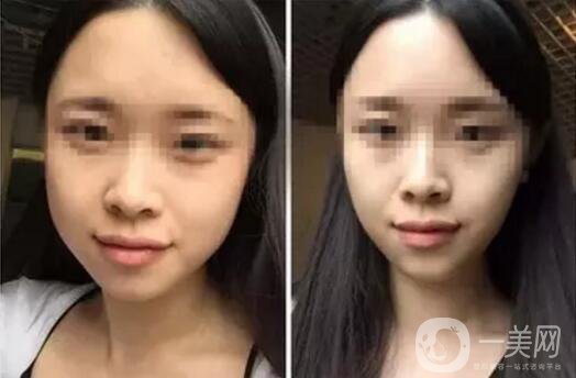 **果好嗎？*前后圖