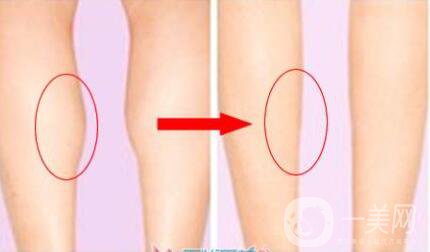 *多少錢 *品牌有哪些