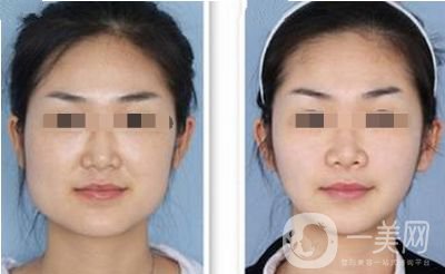 *的價(jià)格 *的作用有哪些