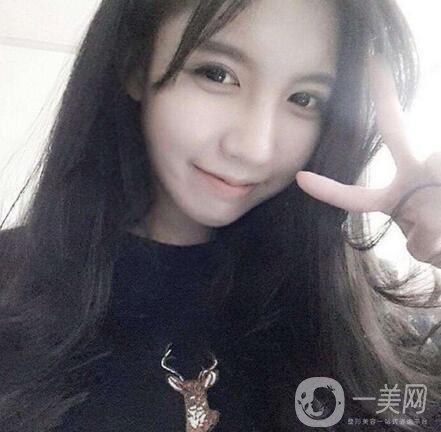 正頜手術(shù)的方法有哪些？