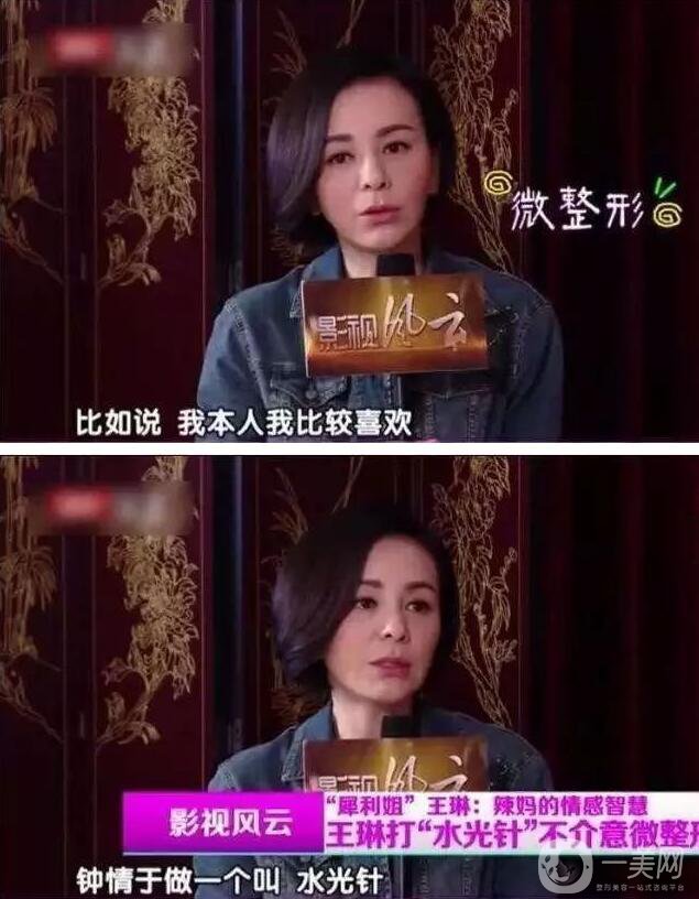 為什么眾多明星都鐘愛*？