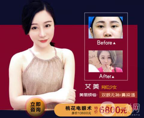 佛山夢露整形醫(yī)院跨年狂歡月 積贊當錢花