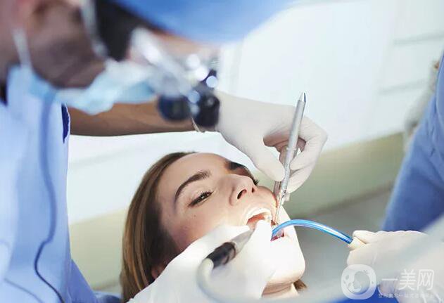 烤瓷牙多久換一次比較好呢？