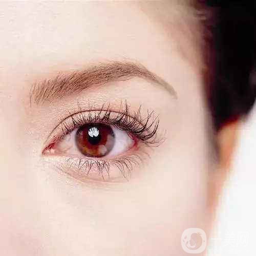 內(nèi)雙怎么變外雙 全切雙眼皮可以嗎