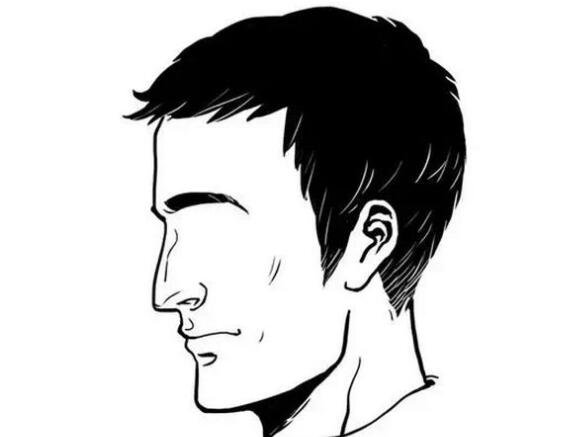 種植胸毛價格 種植胸毛方法有哪些