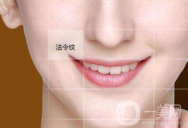 玻尿酸去法令紋手術(shù)價格 *果好不好