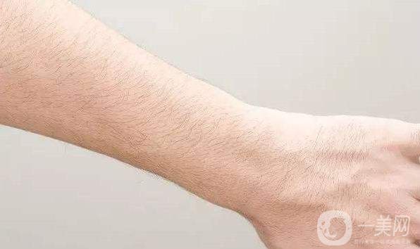 激光脫毛需要幾次 激光脫毛能維持多久