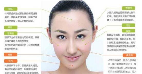面部脂肪填充*果*嗎 注意事項有哪些