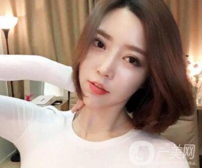 印度班加羅爾下巴整容手術(shù)費(fèi)用 頜骨整容手術(shù)*果