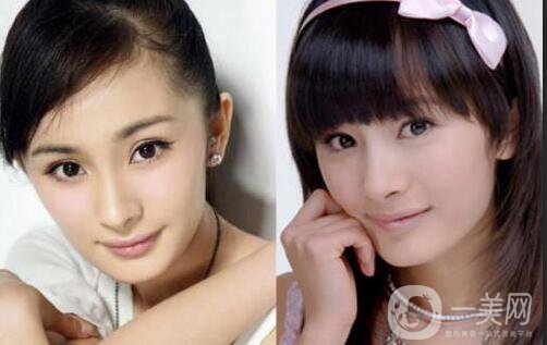 又一個(gè)整容失敗的女明星，鼻子都整歪了，不甘心揚(yáng)言還要植發(fā)！