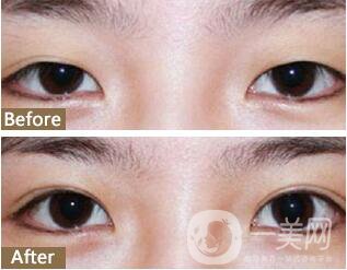 溫州藝星醫(yī)學(xué)美容醫(yī)院