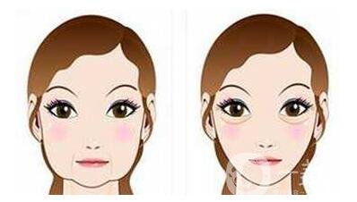 注射*有危險(xiǎn)嗎？