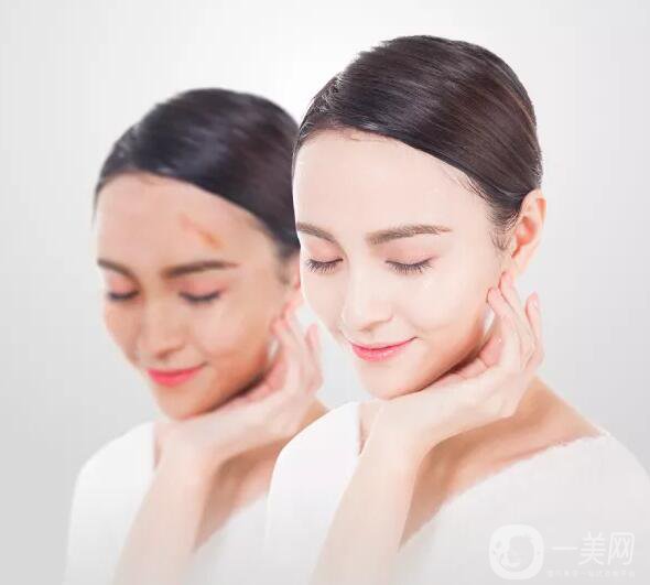 增生疤痕注意事項有哪些？該如何預防及調(diào)節(jié)？