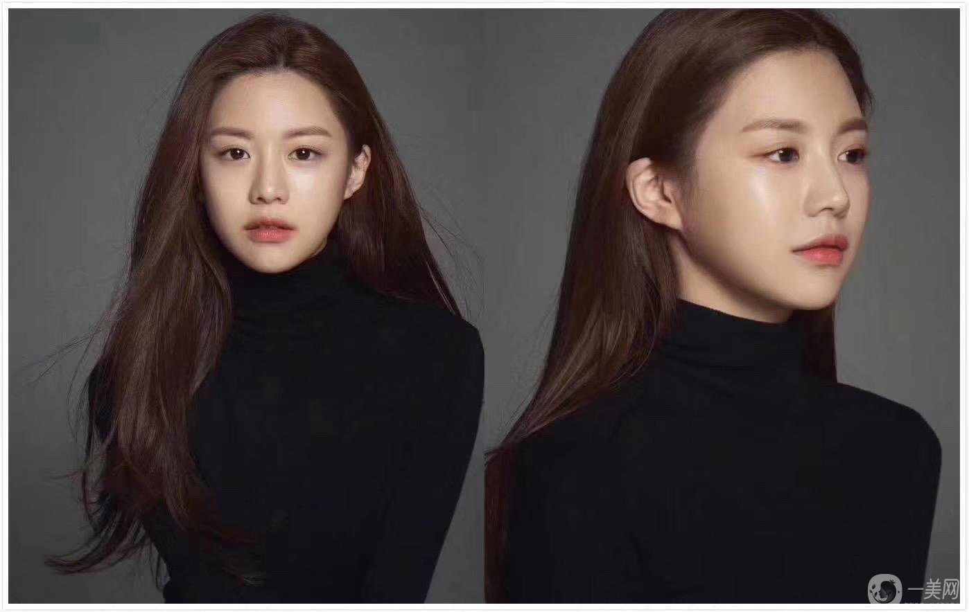 重慶做雙眼皮要多少錢 割雙眼皮喲風險嗎