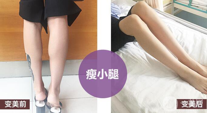 打*有副作用嗎？都有哪些副作用呢？