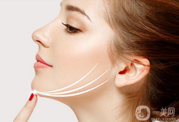 自體脂肪能墊下巴嗎？*果如何？會不會很貴？