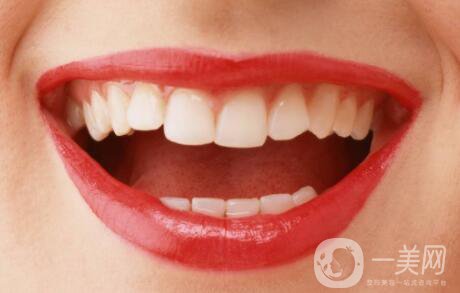 種植牙的過程 種植牙齒的種類有哪些？