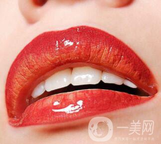 種植牙的過程 種植牙齒的種類有哪些？