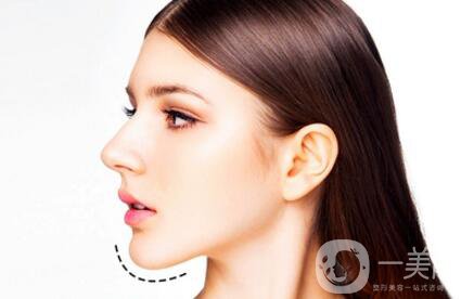 自體脂肪墊下巴恢復(fù)期是怎樣的？如何做好術(shù)后護(hù)理？