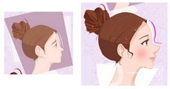 假體豐額頭價(jià)格 膨體和硅膠信息介紹