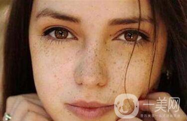 祛斑價(jià)格,祛斑貴不貴