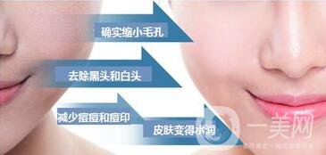 黑臉娃娃價(jià)格表,成都黑臉娃娃報(bào)價(jià)