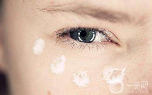 射頻去眼袋貴嗎,射頻去眼袋多少錢