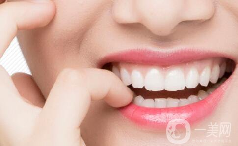 烤瓷牙種類及價(jià)格介紹 烤瓷牙貴嗎？