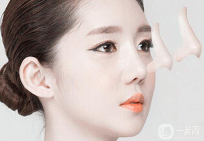 隆鼻哪種好 該如何選擇適合自己的方式？