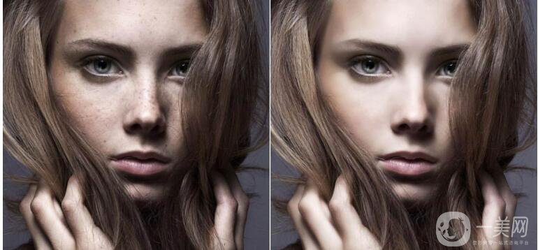 祛斑的價(jià)錢是多少 祛斑的方法有哪些