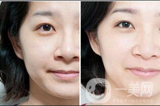 熱瑪吉價(jià)格