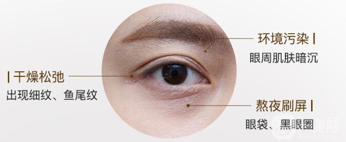 調(diào)節(jié)魚尾紋的方法有哪些 哪種比較適合你？