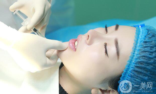 自體脂肪墊下巴貴嗎 一般多少錢？