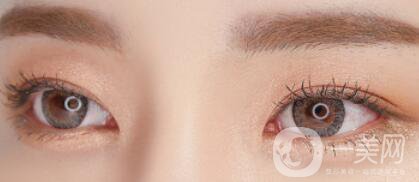 玻尿酸豐臥蠶貴嗎 價格是多少？