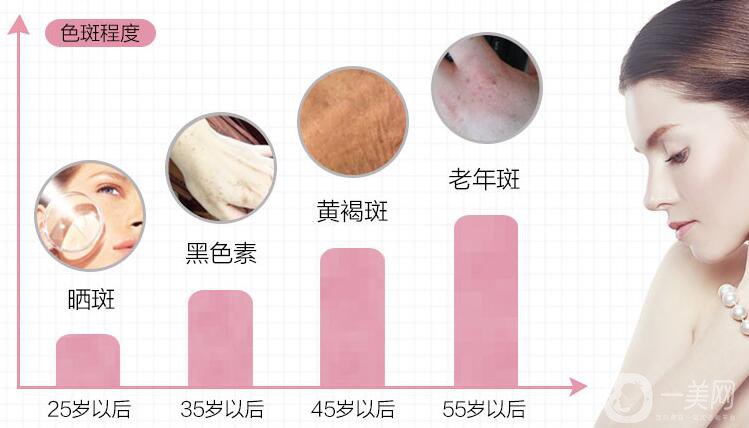 如何調(diào)節(jié)老年斑 都有哪些方式呢？