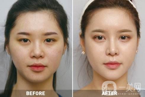 什么是* *對(duì)我合適嗎