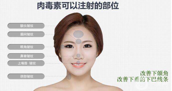 什么是* *對(duì)我合適嗎