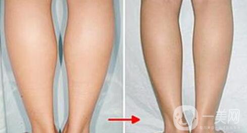 打*多少錢(qián),*價(jià)格盤(pán)點(diǎn)