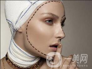 磨骨整形貴,磨骨多少錢