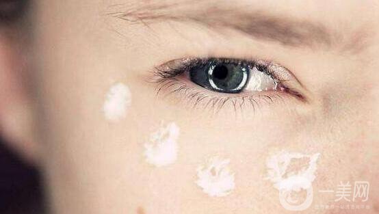 超聲法去眼袋價(jià)格,超聲法去眼袋術(shù)后護(hù)理