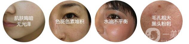 黑臉娃娃*果照,黑臉娃娃價(jià)格