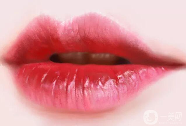 豐唇手術(shù)好嗎 有哪些手術(shù)方式呢？