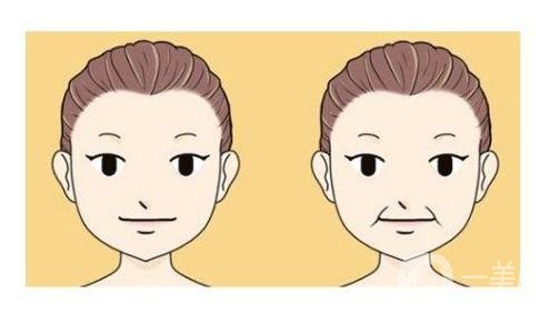 *生物除皺價(jià)格是多少 *果怎么樣