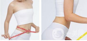 吸脂減肥價格 吸脂減肥適合什么人