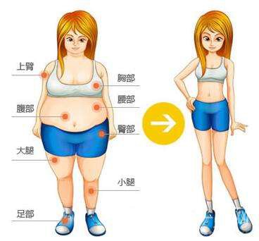 吸脂減肥價格 吸脂減肥適合什么人