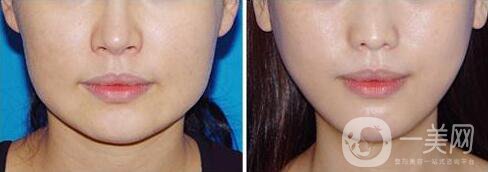 打*價(jià)格,*多久見(jiàn)*