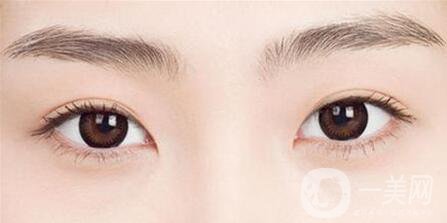 秀眉多少錢 價(jià)格詳解