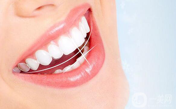 噴砂洗牙原理是怎樣的呢 *果好不好？