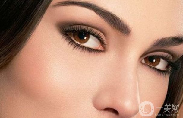 開(kāi)眼角前后照片分享 開(kāi)眼角好不好