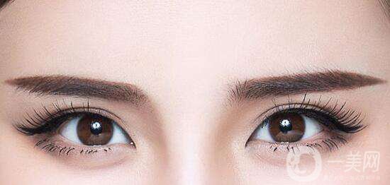 開(kāi)眼角前后照片分享 開(kāi)眼角好不好